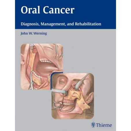 Oral Cancer: Diagnosis, Management, and Rehabilitation
