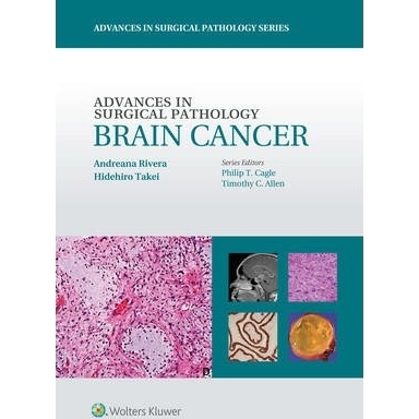 Advances in Surgical Pathology: Brain Cancer, 1st Edition