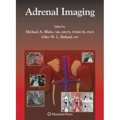 Adrenal Imaging