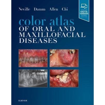 Color Atlas of Oral and Maxillofacial Diseases, 1st Edition