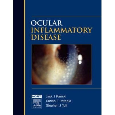 Ocular Inflammatory Disease, 1st Edition