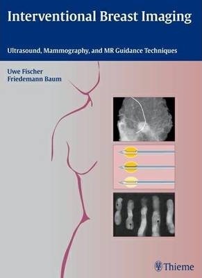Interventional Breast Imaging: Ultrasound, Mammography, and MR Guidance Techniques