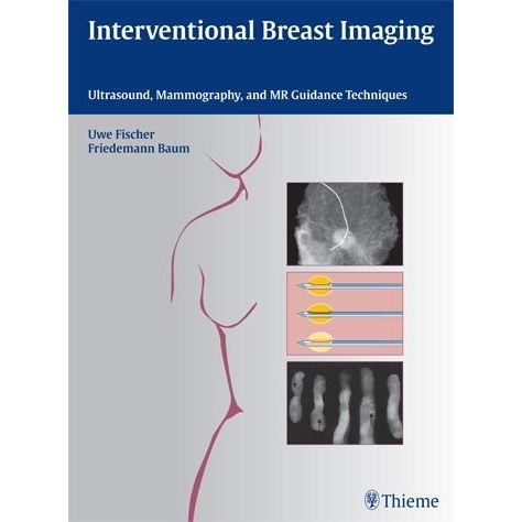 Interventional Breast Imaging: Ultrasound, Mammography, and MR Guidance Techniques