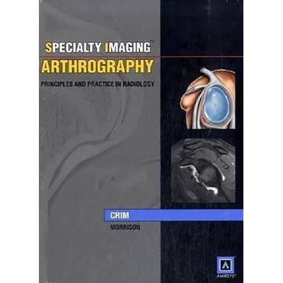Specialty Imaging: Arthrography : Principles and Practice in Radiology (Published by Amirsys), 1st Edition