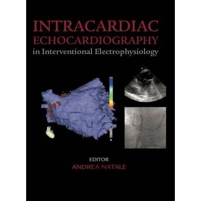 Intracardiac Echocardiography in Interventional Electrophysiology: Adv. Mngmt of Atrial Fibrillation&Ventr. Tach., 1st Edition