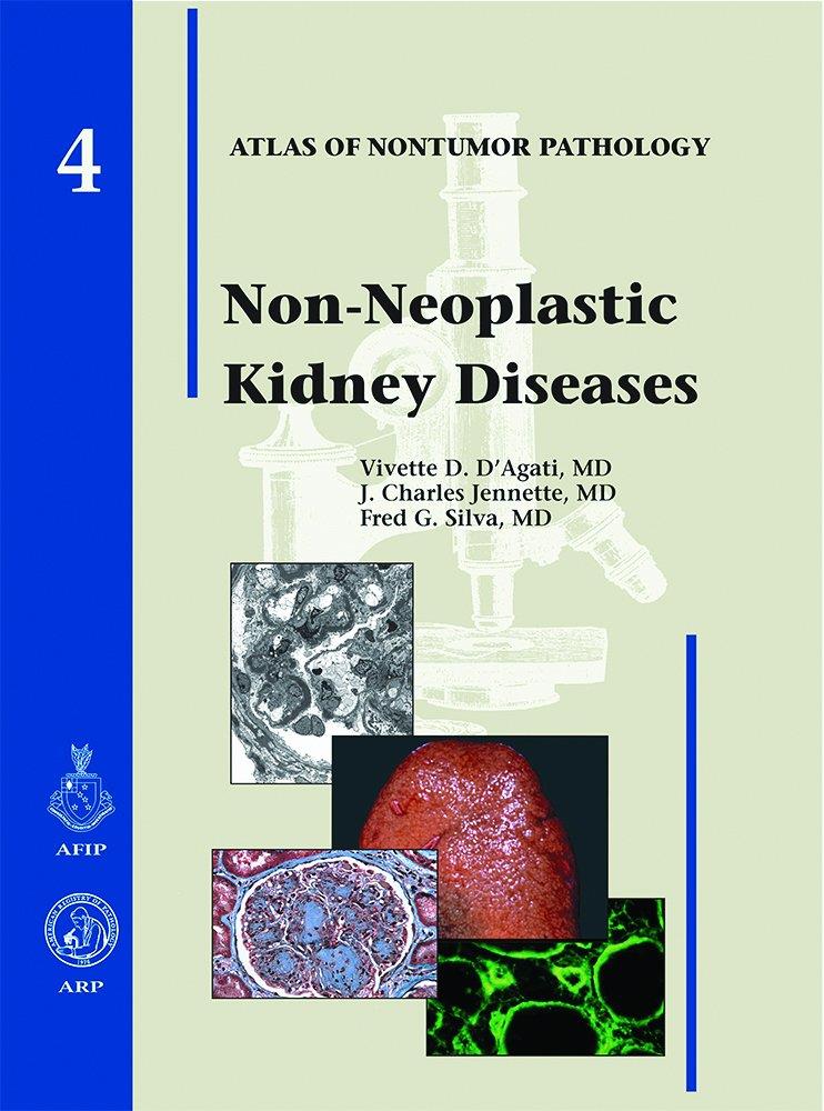 Non-neoplastic Kidney Diseases