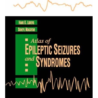 Atlas Of Epileptic Seizures And Syndromes