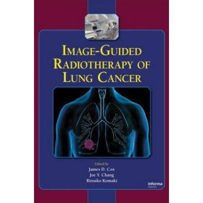 Image-Guided Radiotherapy of Lung Cancer, 1st Edition