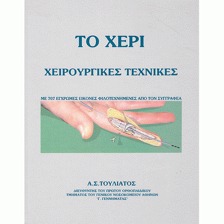 Το Χέρι Χειρουργικές Τεχνικές