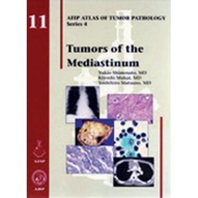 Tumors of the Mediastinum, 1st Edition