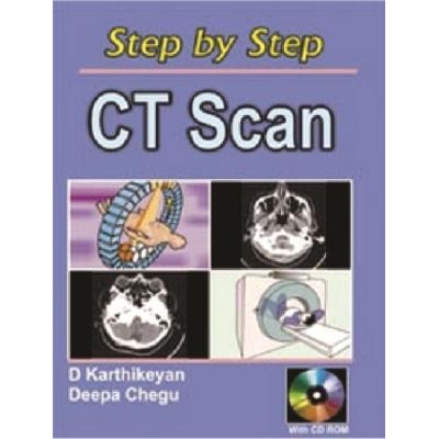 Step by Step CT Scan