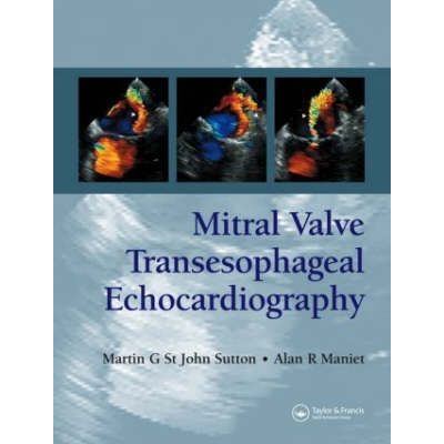 Mitral Valve Transesophageal Echocardiography, 1st Edition