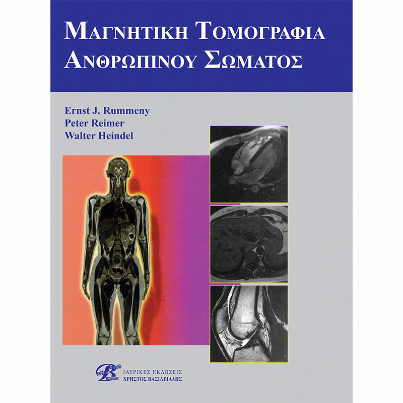 Μαγνητική Τομογραφία Ανθρωπίνου Σώματος