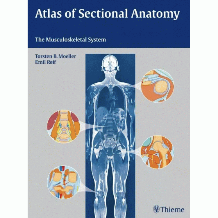 Atlas of Sectional Anatomy: The Musculoskeletal System, 1st Edition