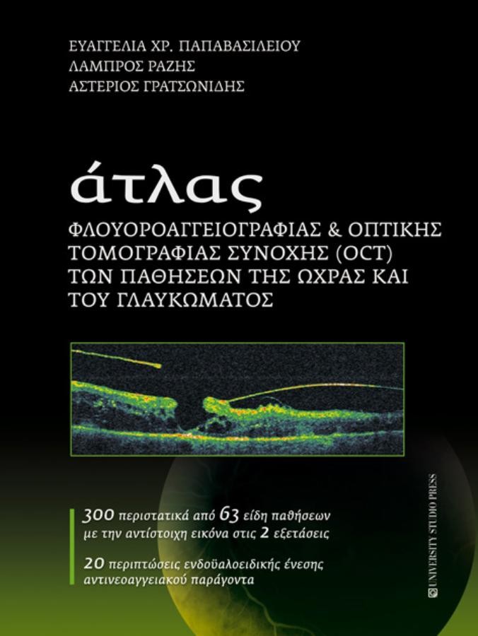 Άτλας Φλουοροαγγειογραφίας & Οπτικής Τομογραφίας Συνοχής (OCT) των Παθήσεων της Ωχράς και του Γλαυκώματος