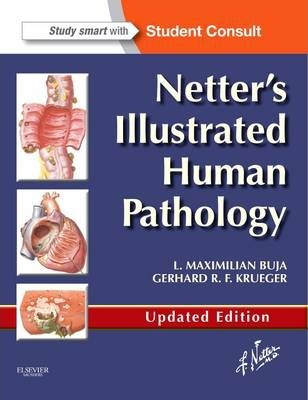 Netter`s Illustrated Human Pathology
