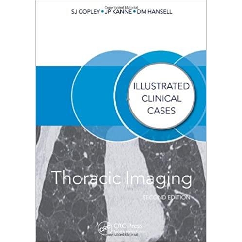THORACIC IMAGING Illustrated Clinical Cases 2ND Edition