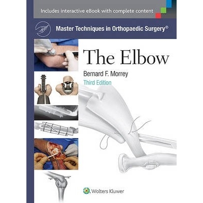 Master Techniques in Orthopaedic Surgery: The Elbow, 3rd Edition