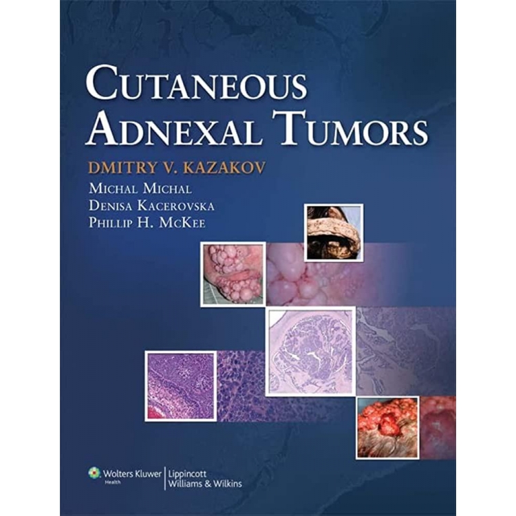 Cutaneous Adnexal Tumors, 1st Edition