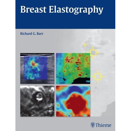 Breast Elastography, 1st Edition