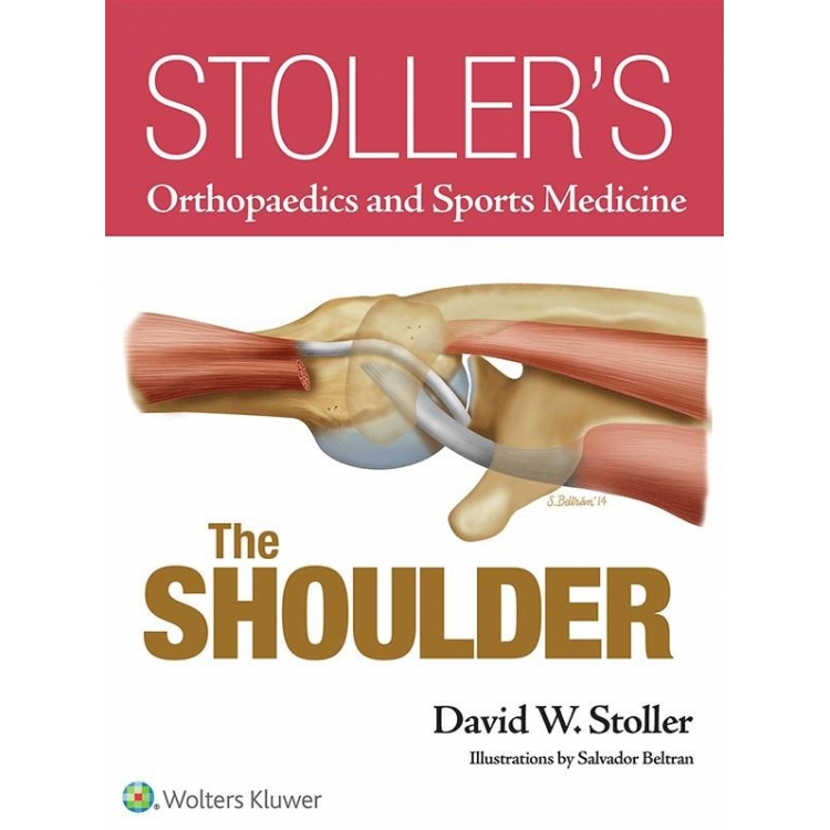 Stoller`s Orthopaedics and Sports Medicine: The Shoulder, 1st Edition