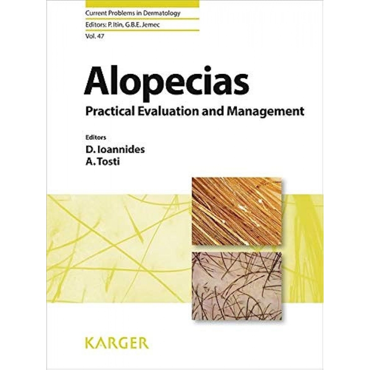 Alopecias - Practical Evaluation and Management