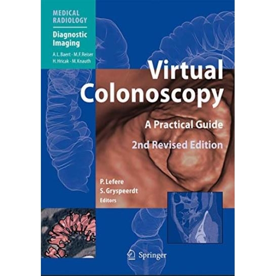 Virtual Colonoscopy : A Practical Guide, 2nd Edition