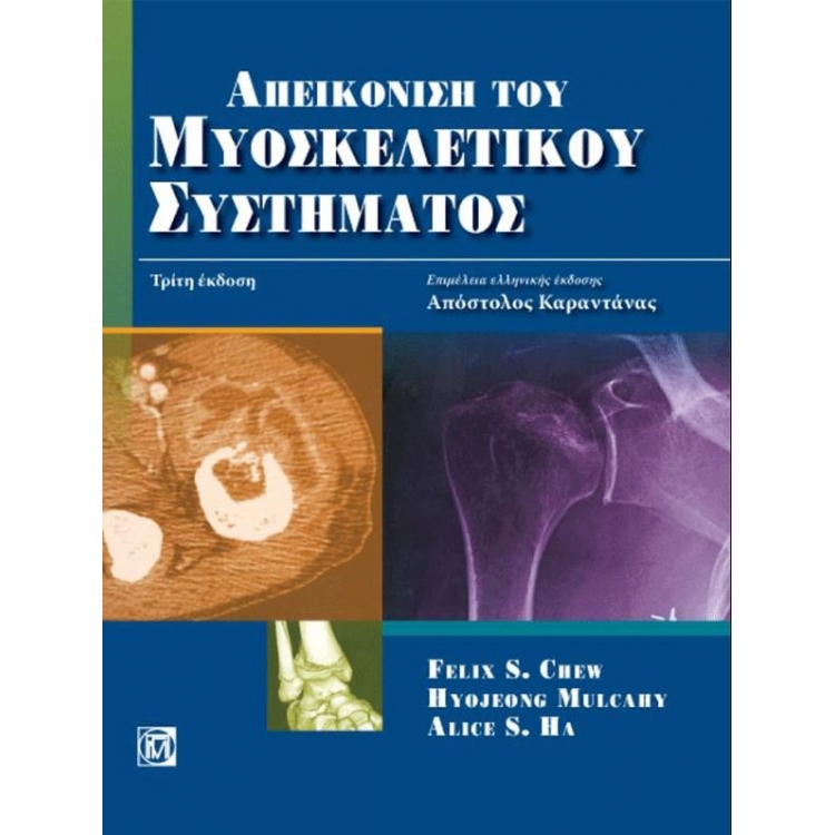 Απεικόνιση του Μυοσκελετικού Συστήματος Chew, 3η Έκδοση