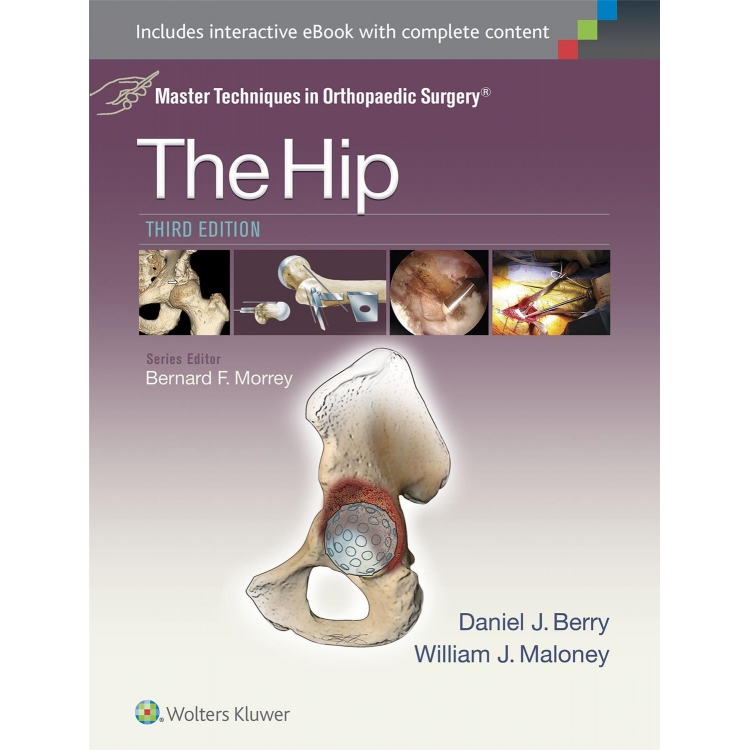 Master Techniques in Orthopaedic Surgery: The Hip, 3rd Edition