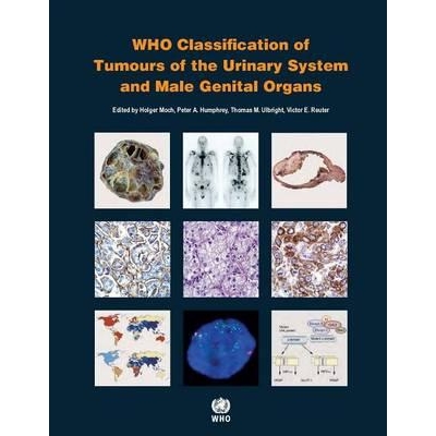 WHO classification of tumours of the urinary system and male genital organs, 4th Edition