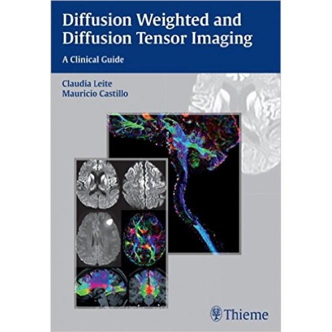 Diffusion Weighted and Diffusion Tensor Imaging: A Clinical Guide