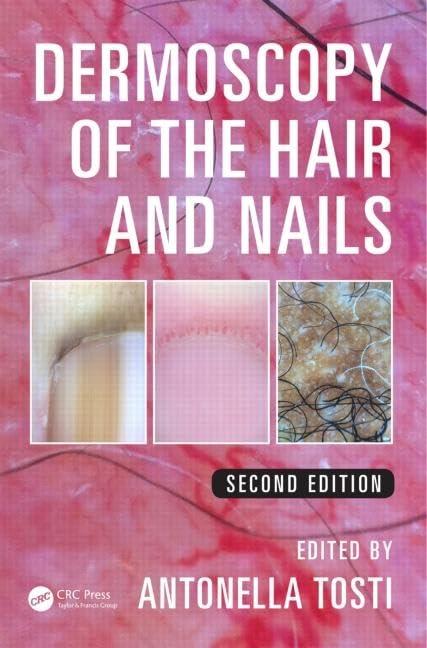 Dermoscopy of the Hair and Nails, 2nd Edition