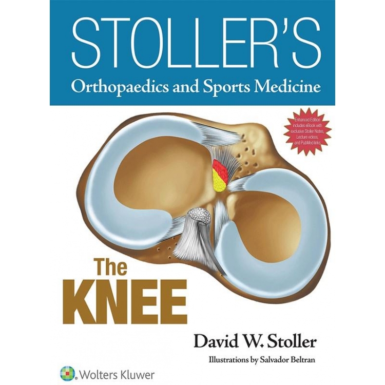 Stoller`s Orthopaedics and Sports Medicine: The Knee, 1st Edition (Includes Stoller Lecture Videos and Stoller Notes)
