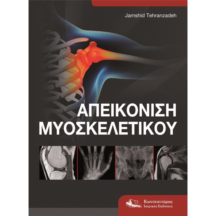 Απεικόνιση Μυοσκελετικού