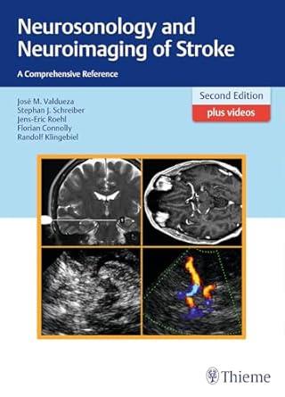 Neurosonology and Neuroimaging of Stroke: A Comprehensive Reference, 2nd Edition