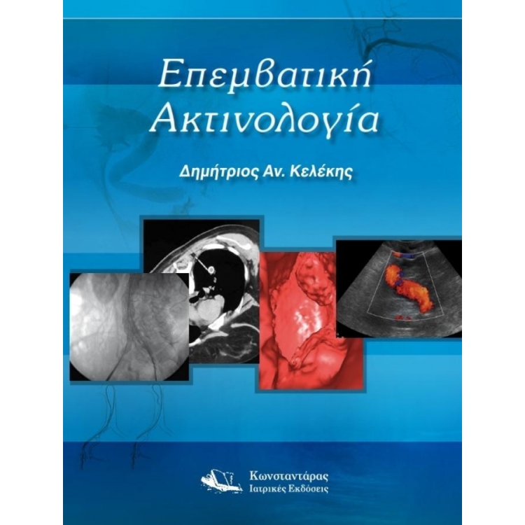 Επεμβατική Ακτινολογία