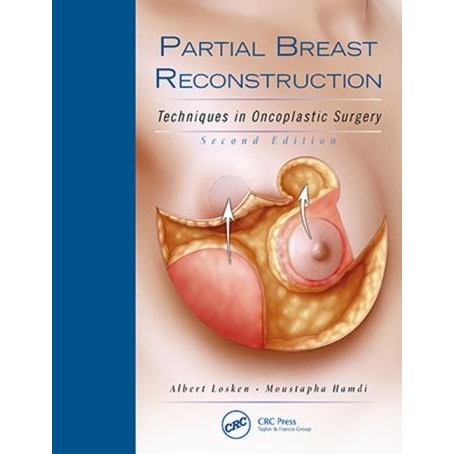 Partial Breast Reconstruction: Techniques in Oncoplastic