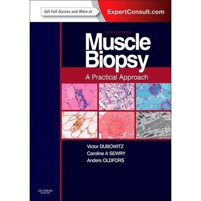 Muscle Biopsy: A Practical Approach : Expert Consult; Online and Print, 4th Edition