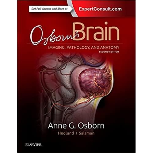 Osborn`s Brain, 2nd Edition