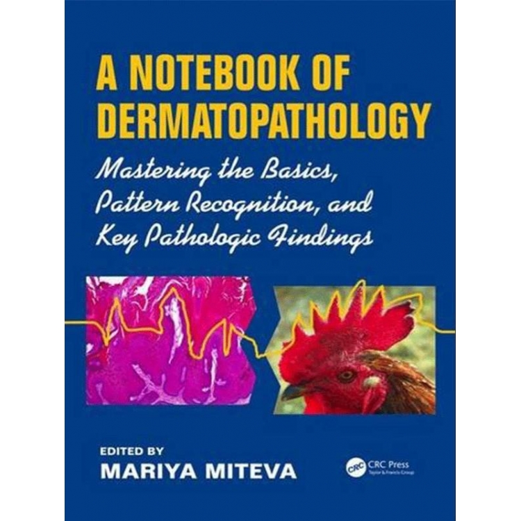 A Notebook of Dermatopathology: Mastering the Basics, Pattern Recognition, and Key Pathologic Findings, 1st Edition