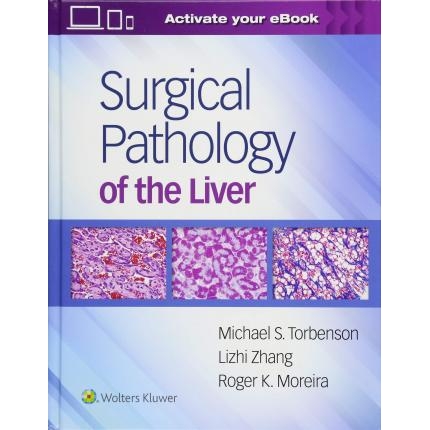 Surgical Pathology of the Liver, 1st Edition