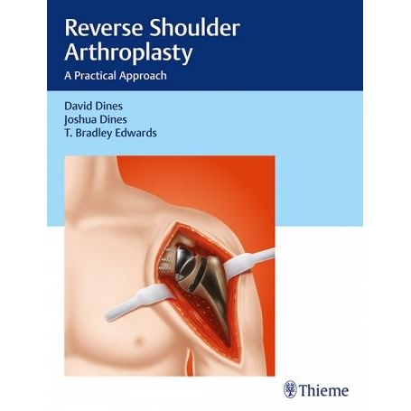 Reverse Shoulder Arthroplasty A Practical Approach