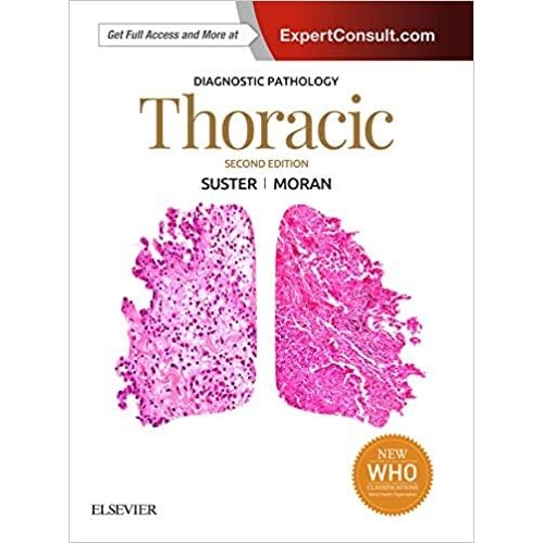 Diagnostic Pathology: Thoracic 2nd Edition