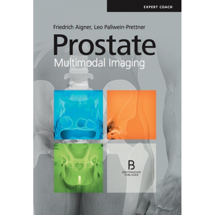 Prostate Multimodal Imaging