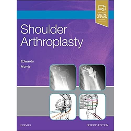 Shoulder Arthroplasty, 2nd Edition