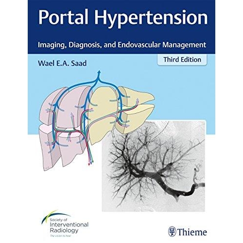 Portal Hypertension Imaging, Diagnosis, and Endovascular Management