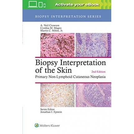 Biopsy Interpretation of the Skin : Primary Non-Lymphoid Cutaneous Neoplasia, 2nd Edition