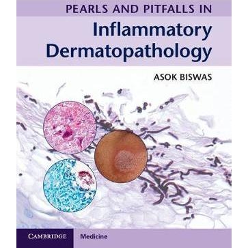 Pearls and Pitfalls in Inflammatory Dermatopathology, 1st Edition