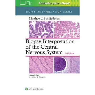Biopsy Interpretation of the Central Nervous System, 2nd Edition