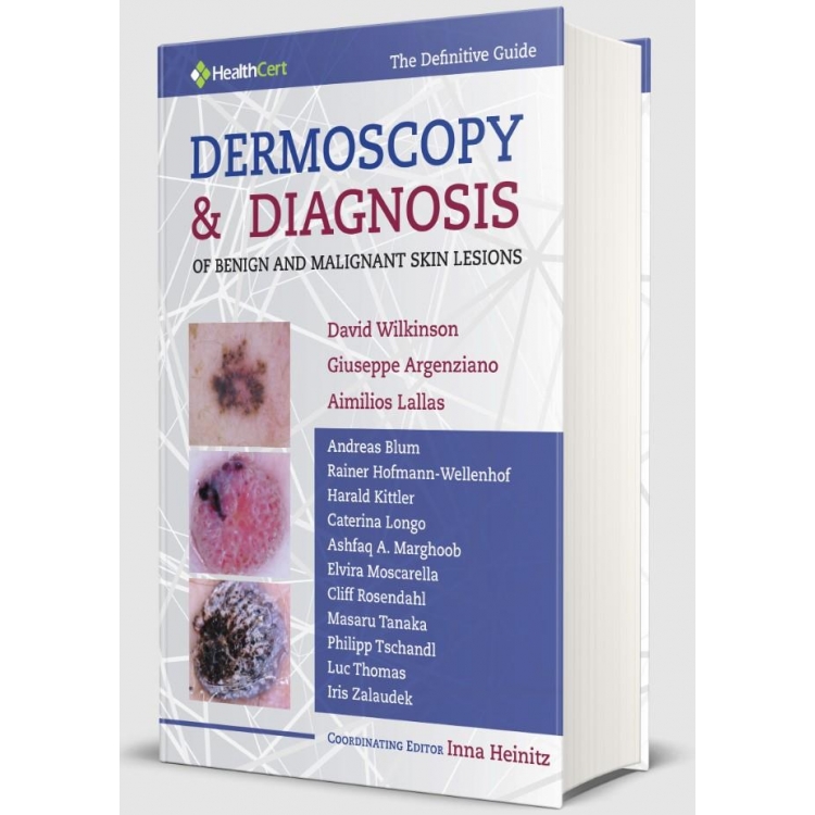 Dermoscopy & Diagnosis  of Benign and Malignant SKIN Lesions